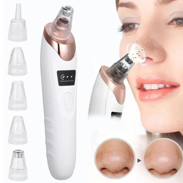 Electric Blackhead Remover – Portable Pore Cleaner-special offer for you