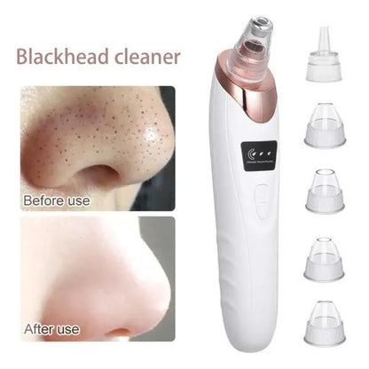 Electric Blackhead Remover – Portable Pore Cleaner-special offer for you