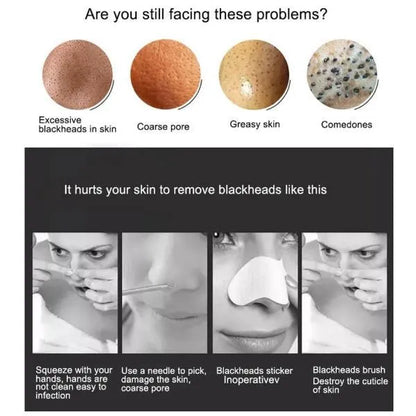 Electric Blackhead Remover – Portable Pore Cleaner-special offer for you