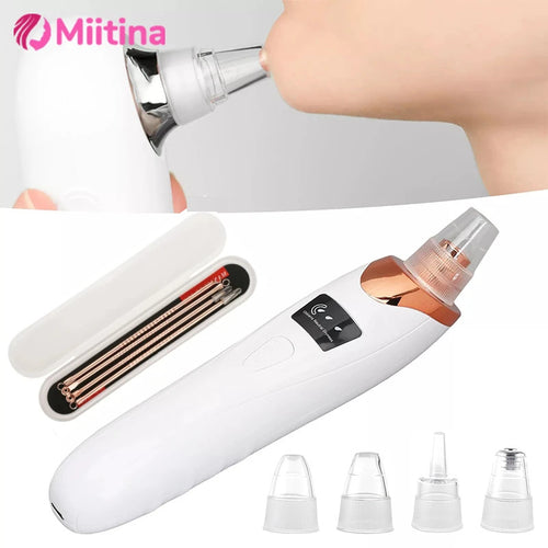 Electric Blackhead Remover – Portable Pore Cleaner-special offer for you